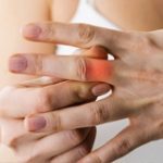 Common Upper Limb Conditions | Action Rehab Hand Therapy Clinic - Shoulder, Elbow, Wrist and Hand Physiotherapists Action Rehab Hand Therapy Clinic - Sprained or Fractured Fingers