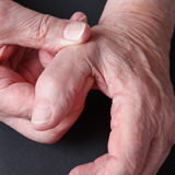 Mallet Finger | Action Rehab Hand Therapy Clinic - Shoulder, Elbow, Wrist and Hand Physiotherapists