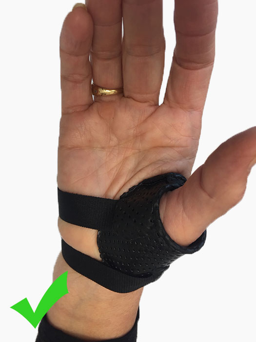 Correct Treatment Thumb Arthritis - Carpometacarpal Osteoarthritis