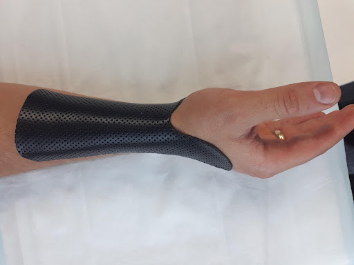 Sports Playing Guard | Action Rehab Hand Therapy Clinic