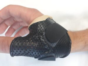Thumb Spica | Action Rehab Hand Therapy Clinic