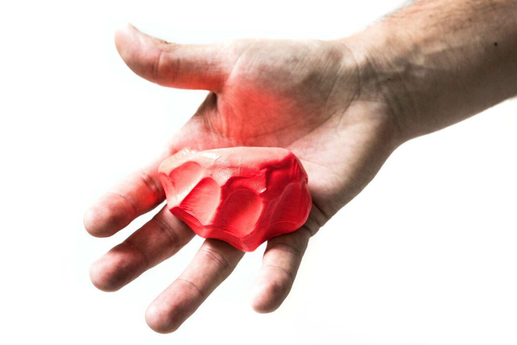 jersey-finger-treatment-brisbane