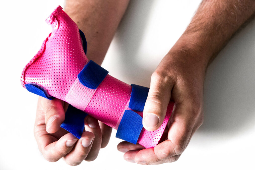 Custom Waterproof Hand Splint | Action Rehab Hand Therapy Clinic