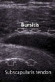 Bursitis Imaging