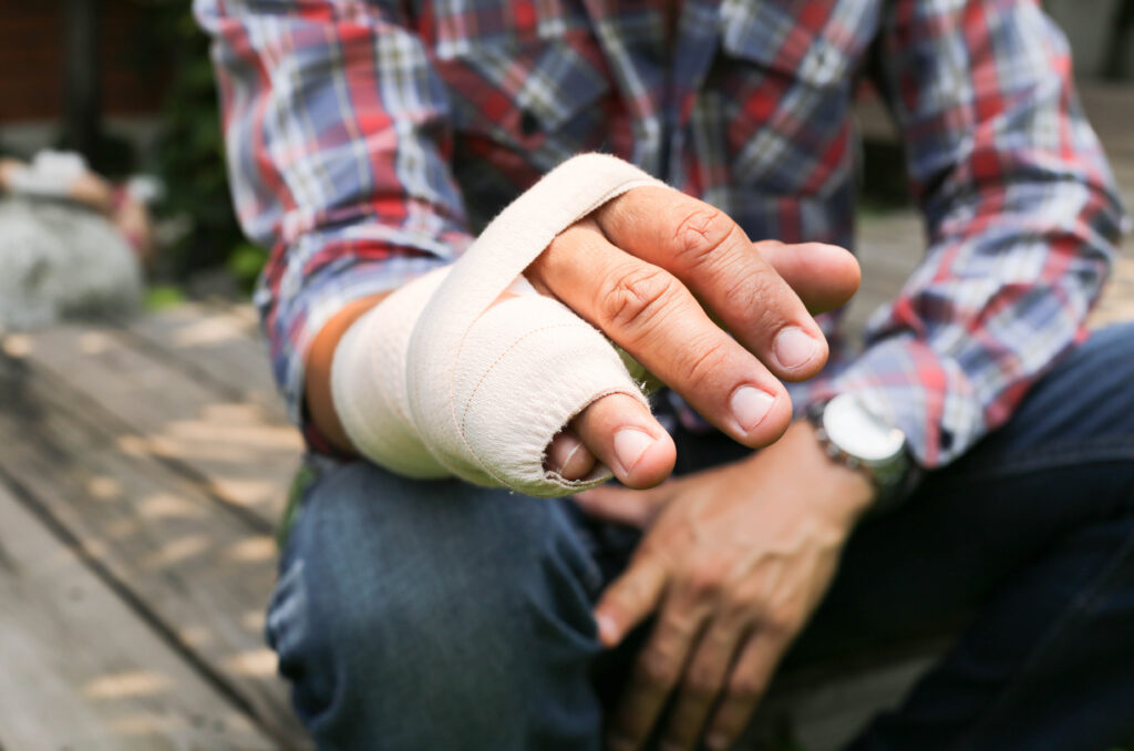 Hand Injury Splinting - Broken Bone Splint | Action Rehab Hand Therapy Clinic
