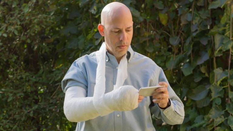 Action Rehab Hand Therapy Clinic splints and casts