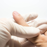 Common Upper Limb Conditions | Action Rehab Hand Therapy Clinic - Shoulder, Elbow, Wrist and Hand Physiotherapists Brisbane Central Slip Injury Treatment | Action Rehab Hand Therapy Clinic