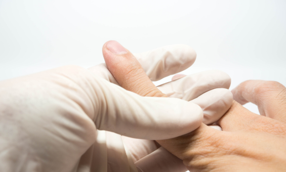 Brisbane Central Slip Injury Treatment | Action Rehab Hand Therapy Clinic