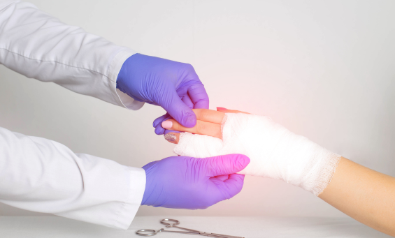 De Quervain's Tenosynovitis Treatment Brisbane | Action Rehab Hand Therapy Clinic