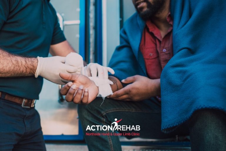 Journal | Action Rehab Hand Therapy Clinic - Shoulder, Elbow, Wrist and Hand Physiotherapists Gripped by Injury Exploring Hand Crush Injuries | Action Rehab Northside Hand & Upper Limb Clinic