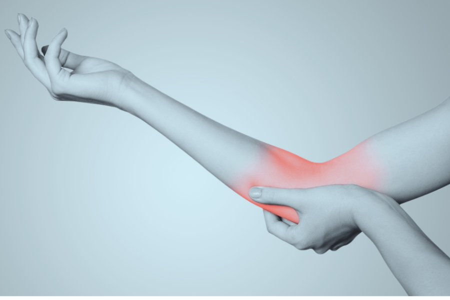 Cubtial Tunnel Syndrome & The Ulnar Nerve | Action Rehab Hand Therapy Clinic - Shoulder, Elbow, Wrist and Hand Physiotherapists
