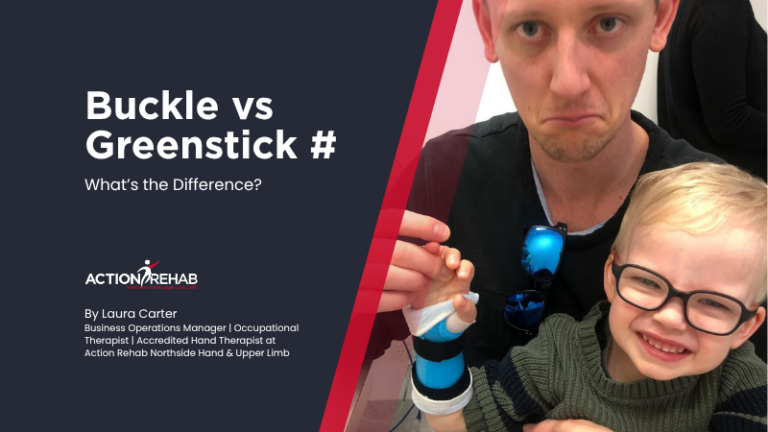 Action Rehab buckle vs greenstick fractures comparison with child in wrist splint