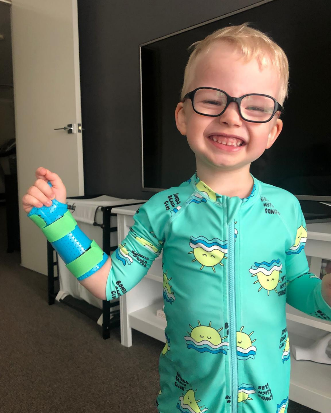 Child wearing a wrist splint for buckle fracture recovery at Action Rehab