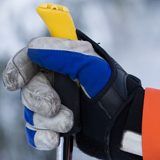 Action Rehab Hand Therapy Clinic - Skiers Thumb